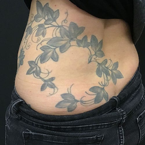 Laser Tattoo Removal Lower Back After Photo