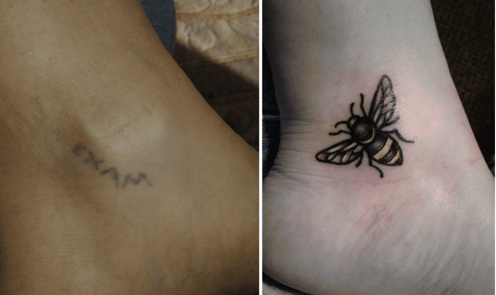 bee tattoo cover up