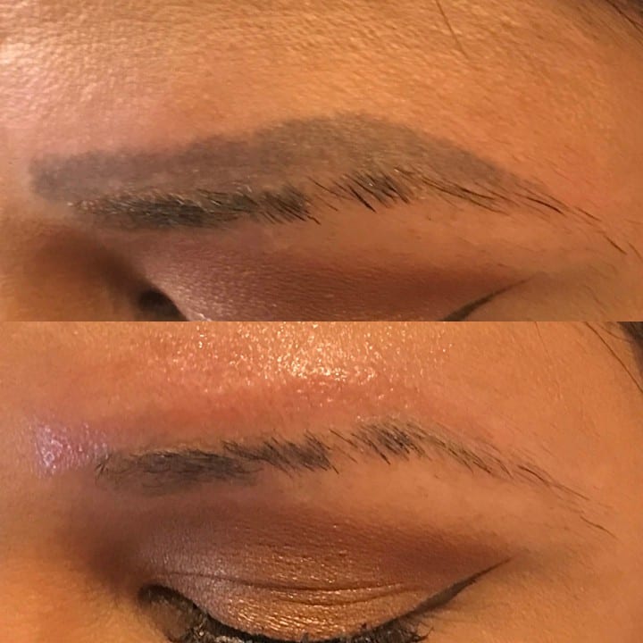 How Many Sessions To Remove Eyebrow Tattoo Laser Tattoo