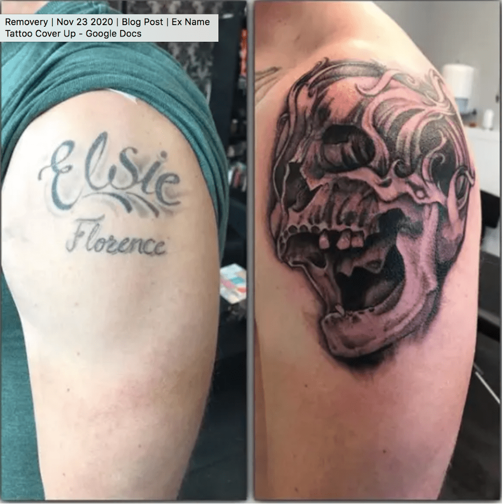 Totenkopf Tattoo vertuschen
