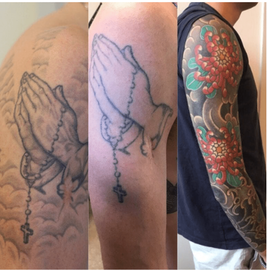How to lighten tattoo ink