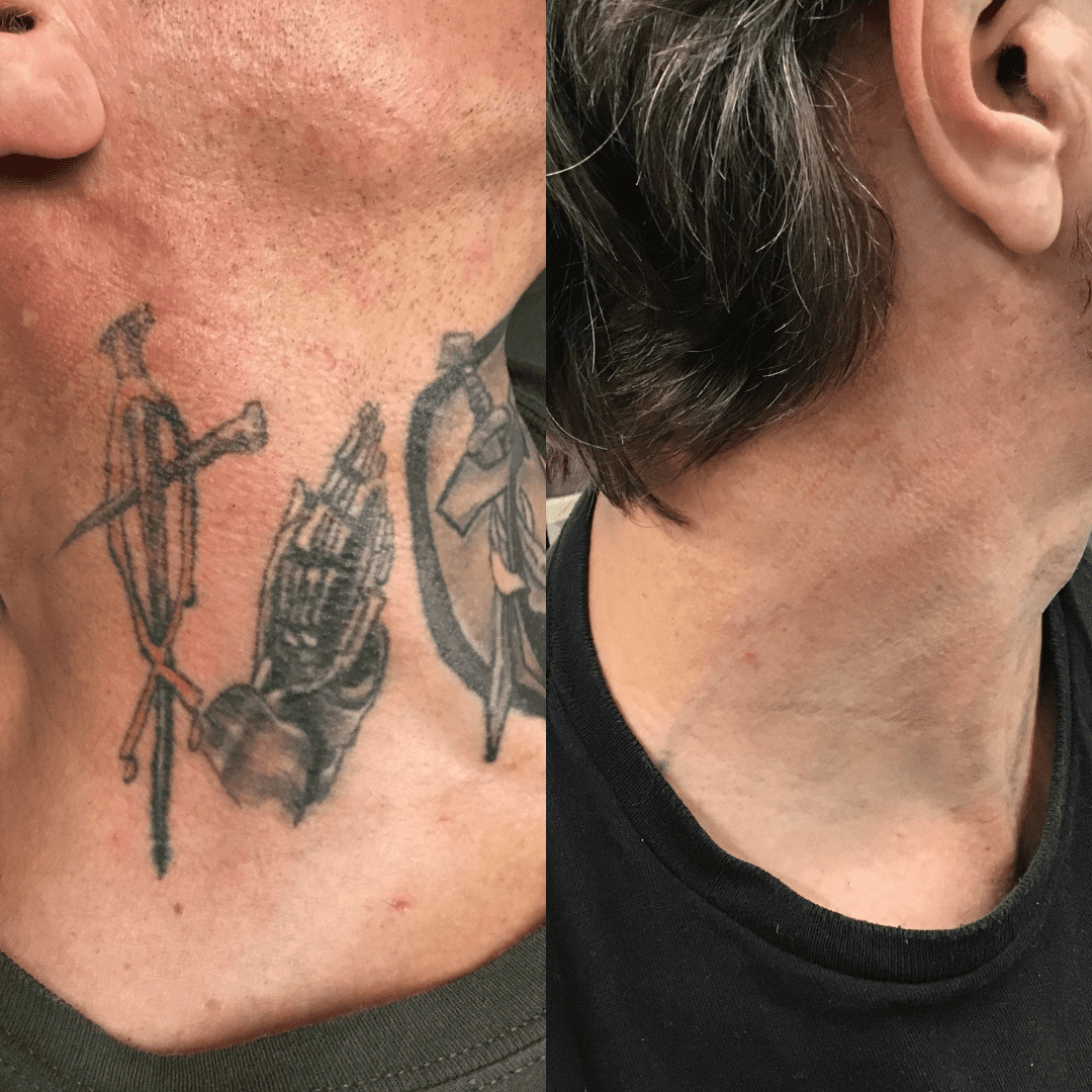 Neck Tattoo- Skull Hands