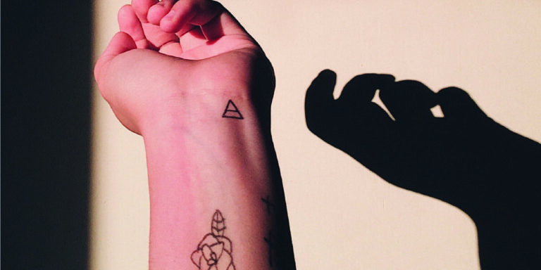 ¿La eliminación de tatuajes con láser deja cicatrices?