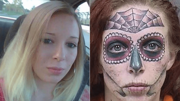 Alyssa Zebrasky's Face Tattoo Removal Journey | Removery
