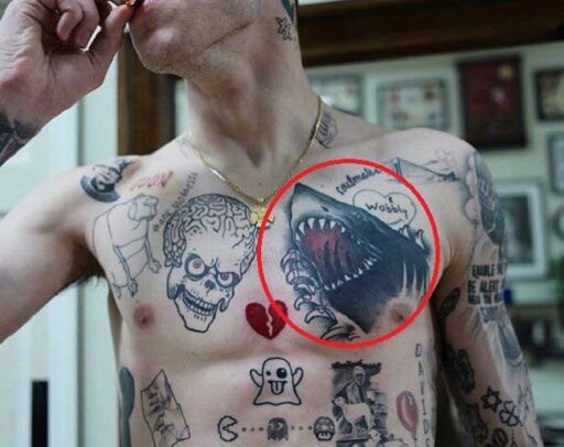 Pete Davidson Tattoo Removal