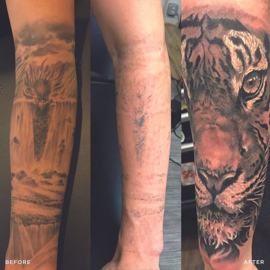 Here's Proof Dark Tattoo Cover Ups Work | Removery