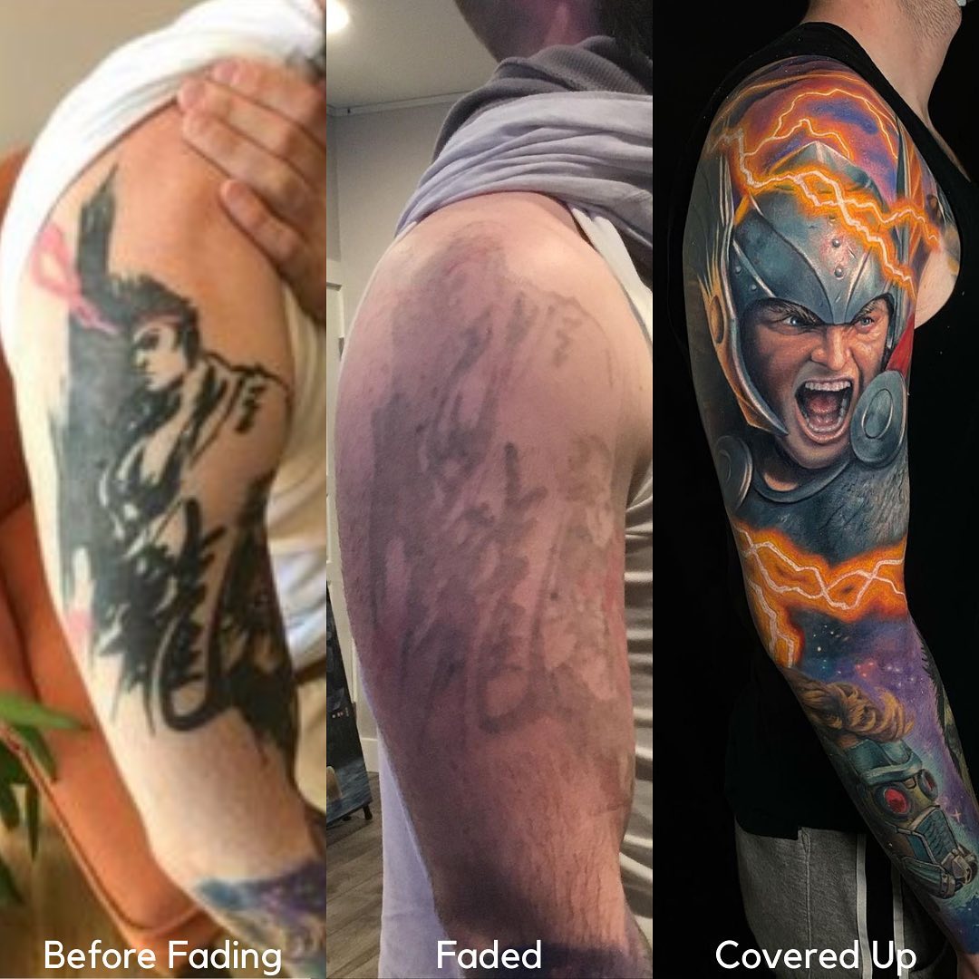 cover up tattoo after laser removal