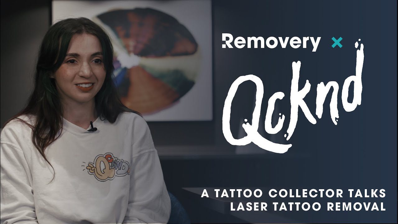 Qcknd Tattoo Removal 