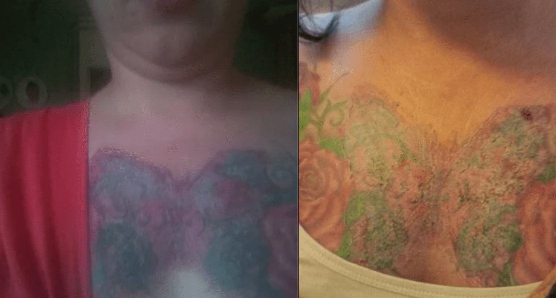 Does bleaching cream fade tattoos