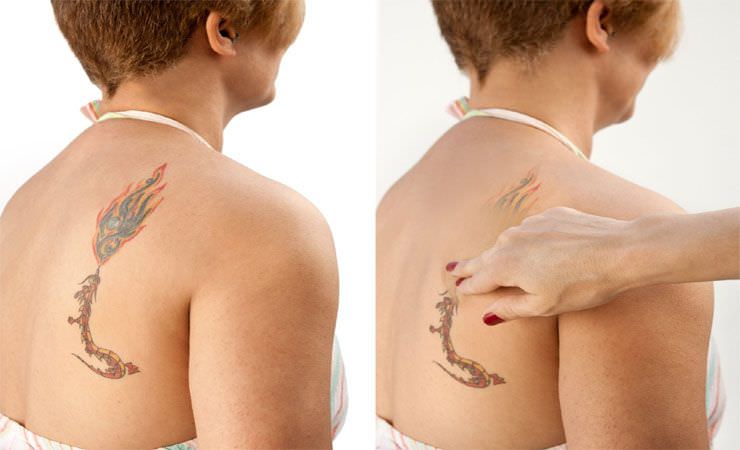 How to Choose a Cover Up Tattoo (Everything You Need to Know)