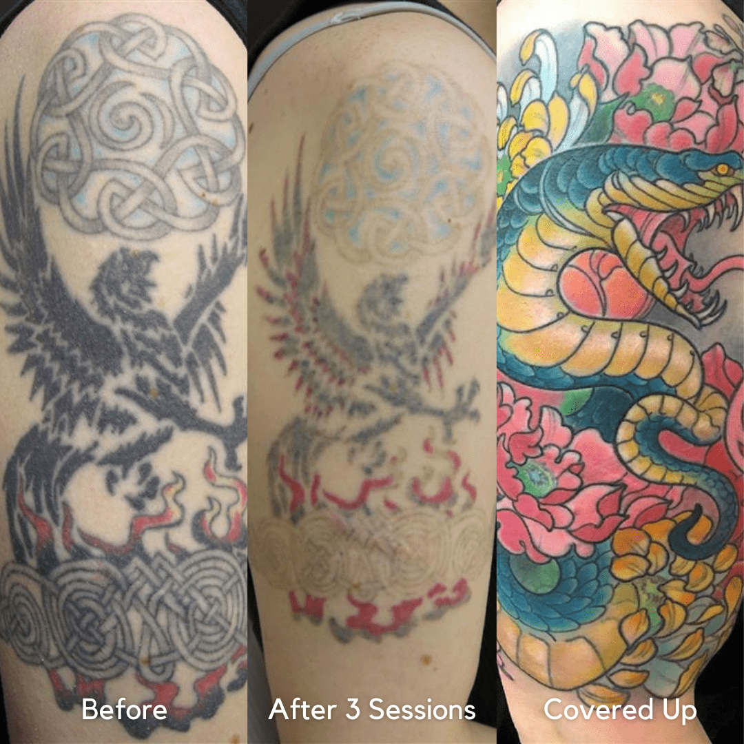 How to Choose a Cover Up Tattoo (Everything You Need to Know)
