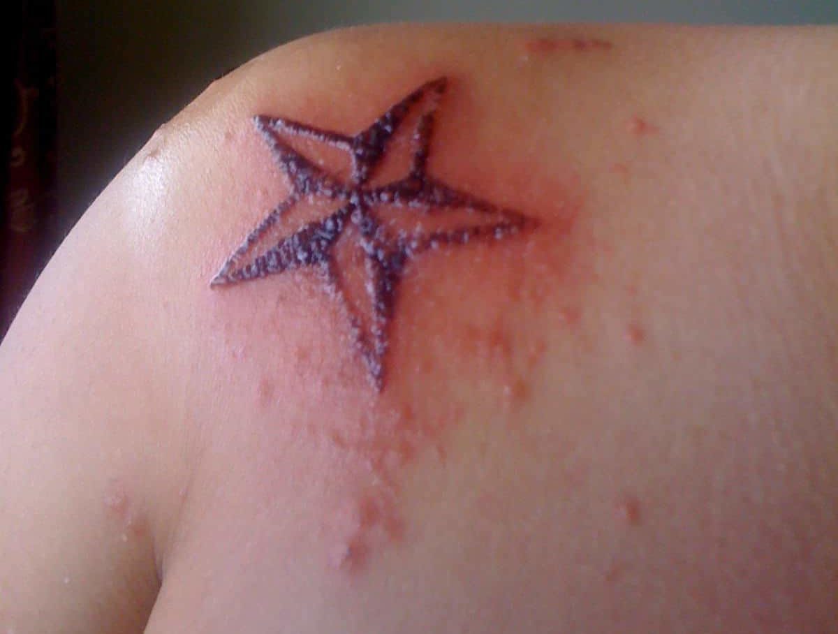 Tattoo-Infektion, Stadien der Tattoo-Infektion, infiziertes Tattoo, Tattoo-Blasenbildung, Tattoo-Ausschlag, Tattoo-Narbenbildung, Tattoo-Schwellung, Tattoo-Entzündung, Allergien gegen rotes Tattoo, Tattoo-Allergie, juckendes Tattoo, erhabenes Tattoo