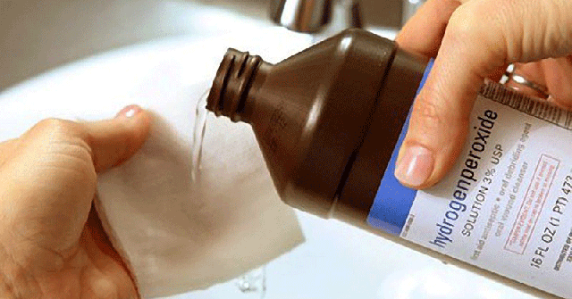 Hydrogen peroxide for tattoo removal