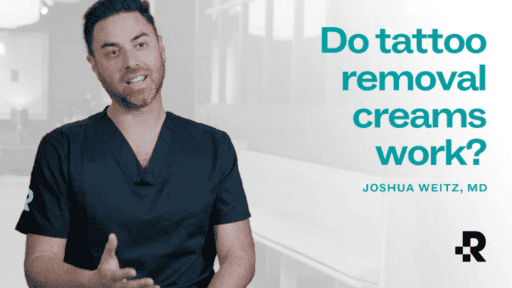 Do tattoo removal creams work?
