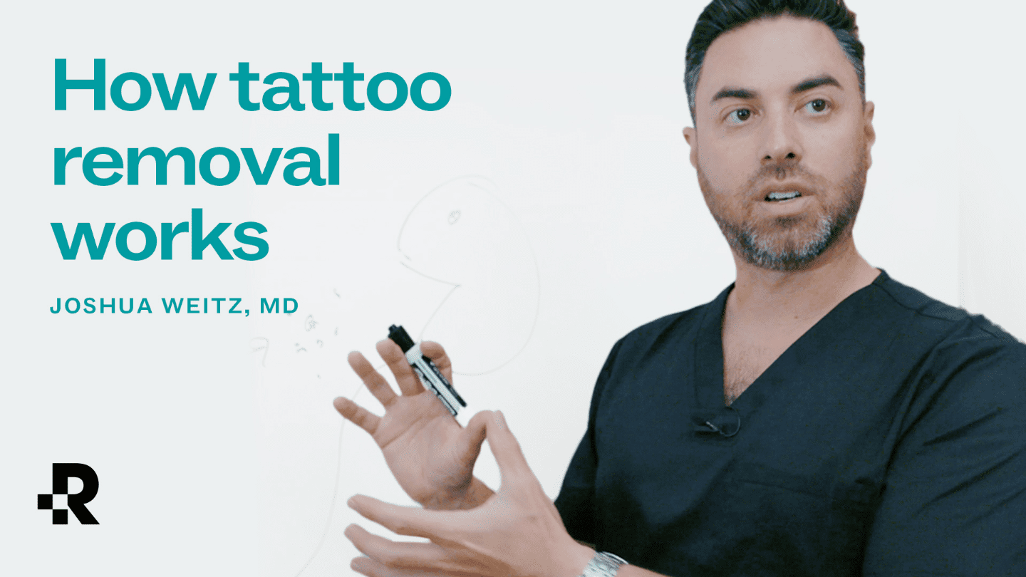 how tattoo removal works