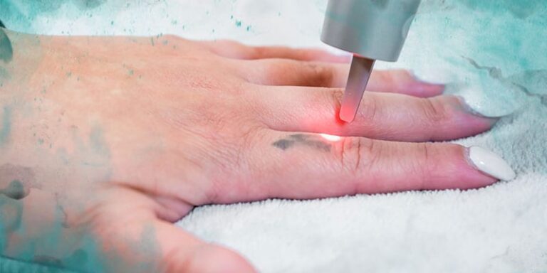 Revamp Your Ink: Stunning Tattoo Cover Up Ideas