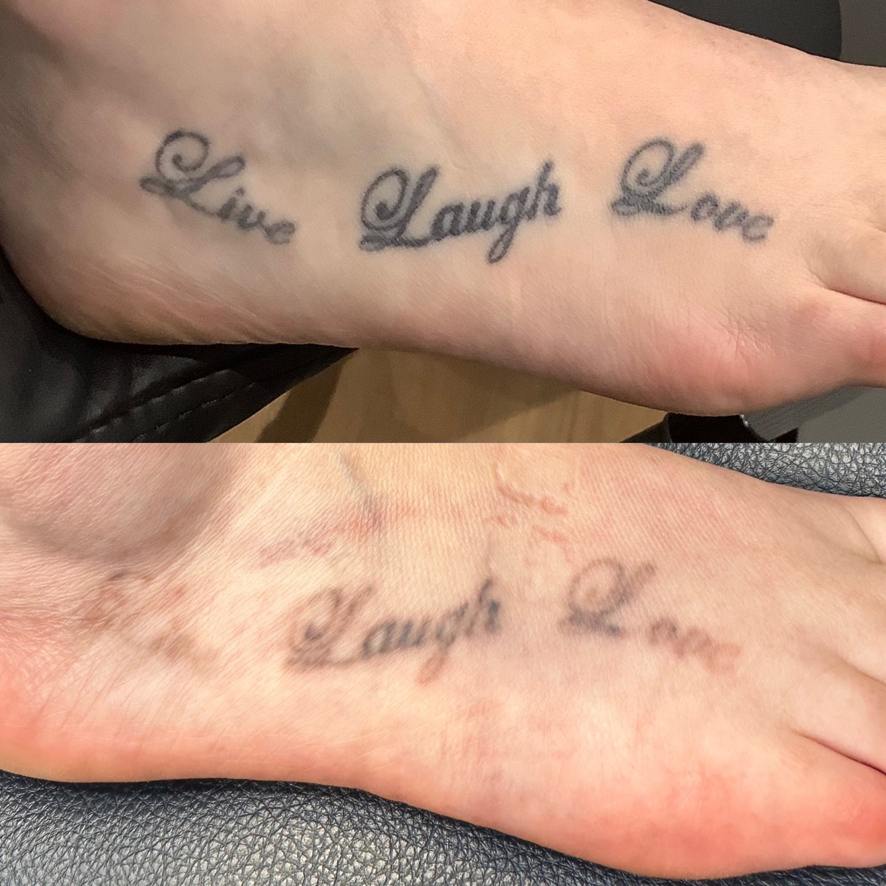 lauren-pay-national-tattoo-removal-day-2