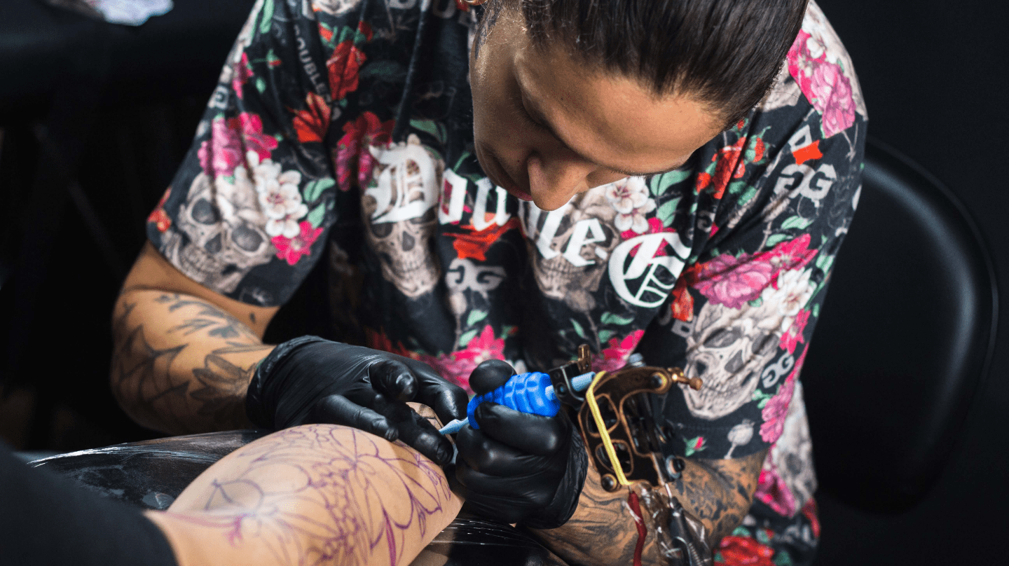 What is The Fastest Tattoo Removal Method?