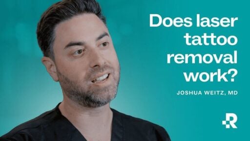 Does_laser_tattoo_removal_work
