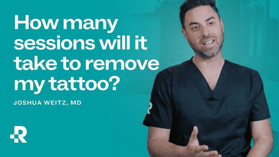 how_many_sessions_to_remove_my_tattoo?