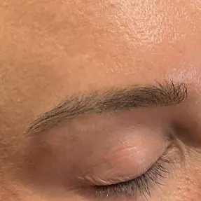 después de la eliminación