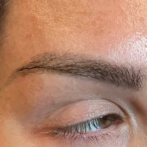 antes de la eliminación