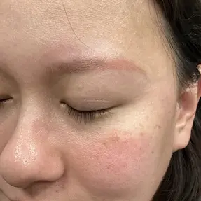 después de la eliminación