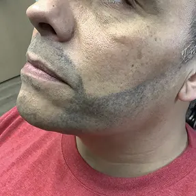 después de la eliminación