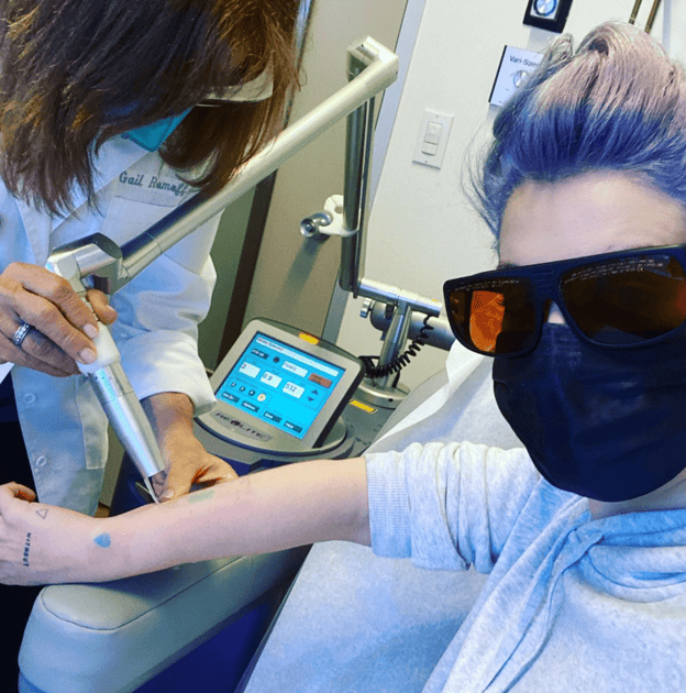 Celebrity Tattoo Removal: 8 Famous Stars Who Chose a Fresh Start