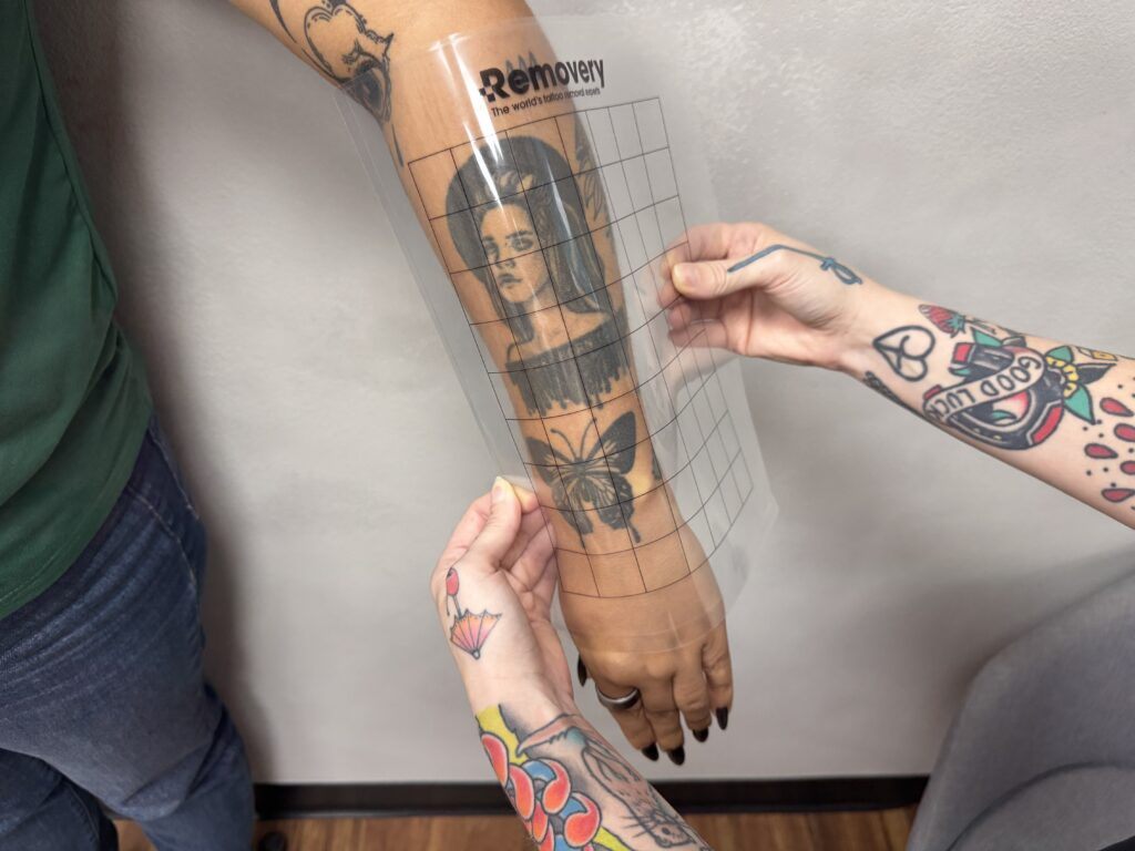 Removery specialist measuring a client’s tattoo with a 1-inch grid